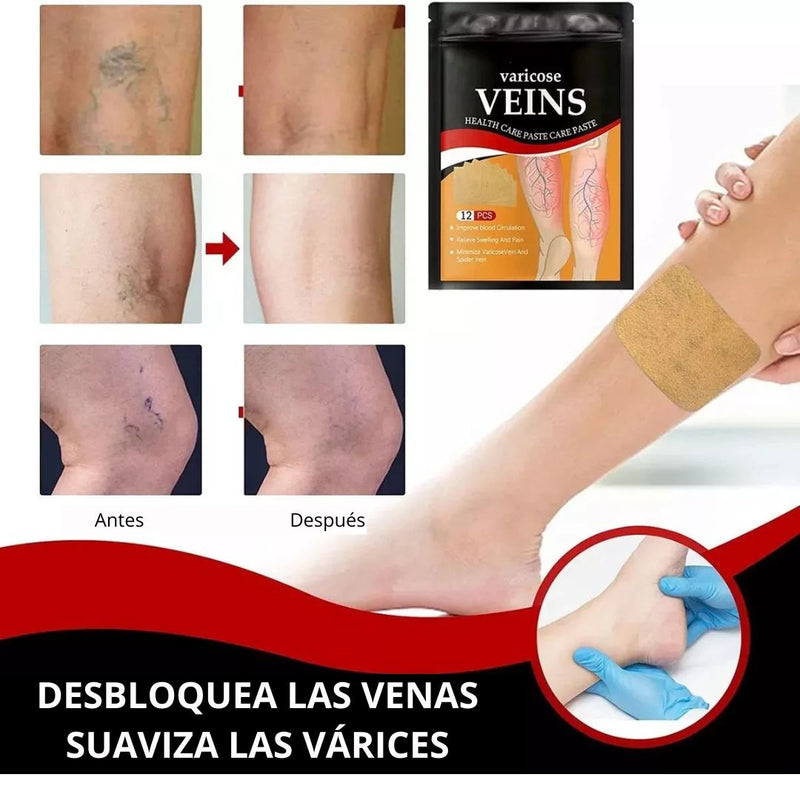 Parche varicose Veins para vena varice