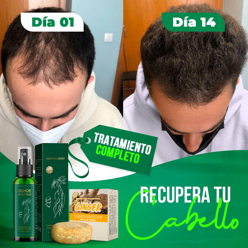 OUHOE Spray Crece Pelo