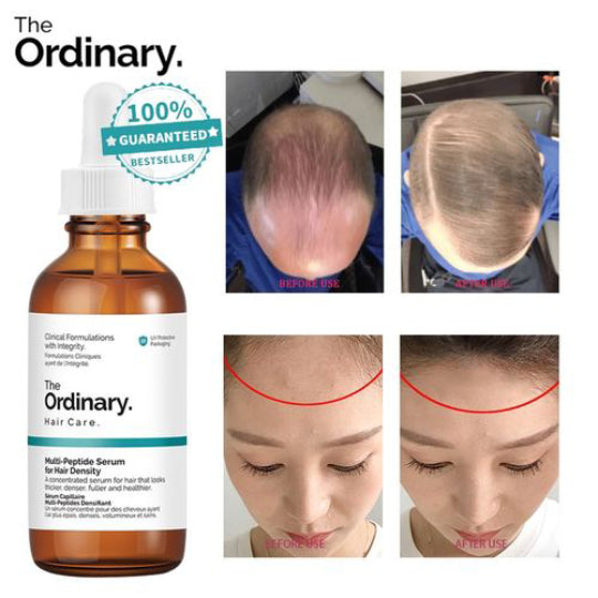 Suero Capilar Anti‑Caída The Ordinary - Multi‑Péptidos + Resultados en 15 días