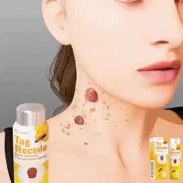 MEGA PROMOCION! 2x1!  Eliminador de Verrugas-Tag Recede®
