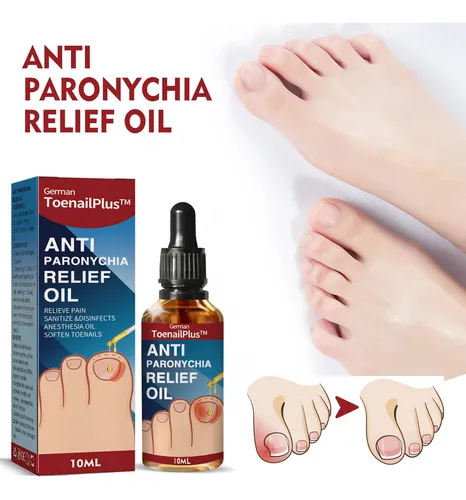 FUNGUSFREE - ANTI HONGO TOENAILPLUS - Compra 1 y llévate 2!