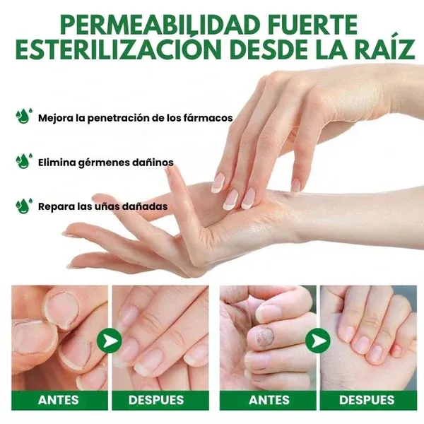 FUNGUSFREE - ANTI HONGO TOENAILPLUS - Compra 1 y llévate 2!